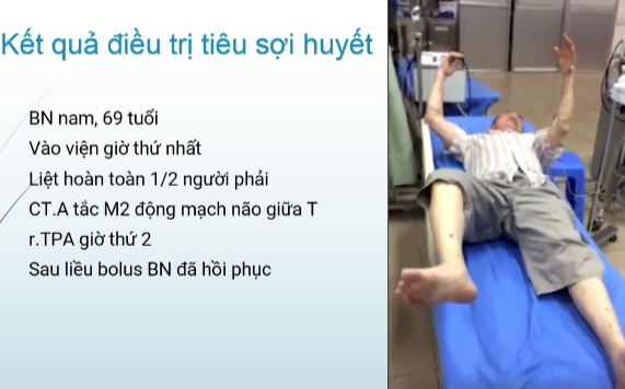 KẾT QUẢ ĐIỀU TRỊ ĐỘT QUỴ NHỒI MÁU NÃO TẠI TRUNG TÂM ĐỘT QUỴ Siêu nổ hũ
